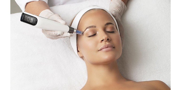 Dermapen – wskazania, przeciwwskazania, opis zabiegu, postępowanie po zabiegu